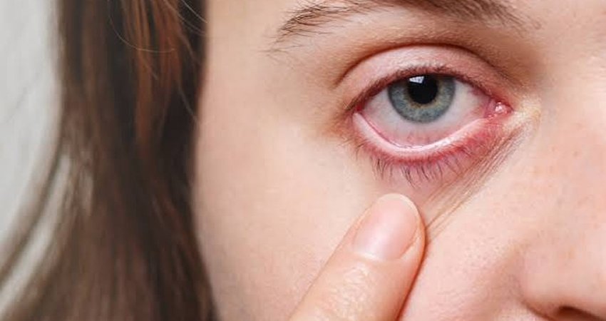 OCT For Glaucoma
